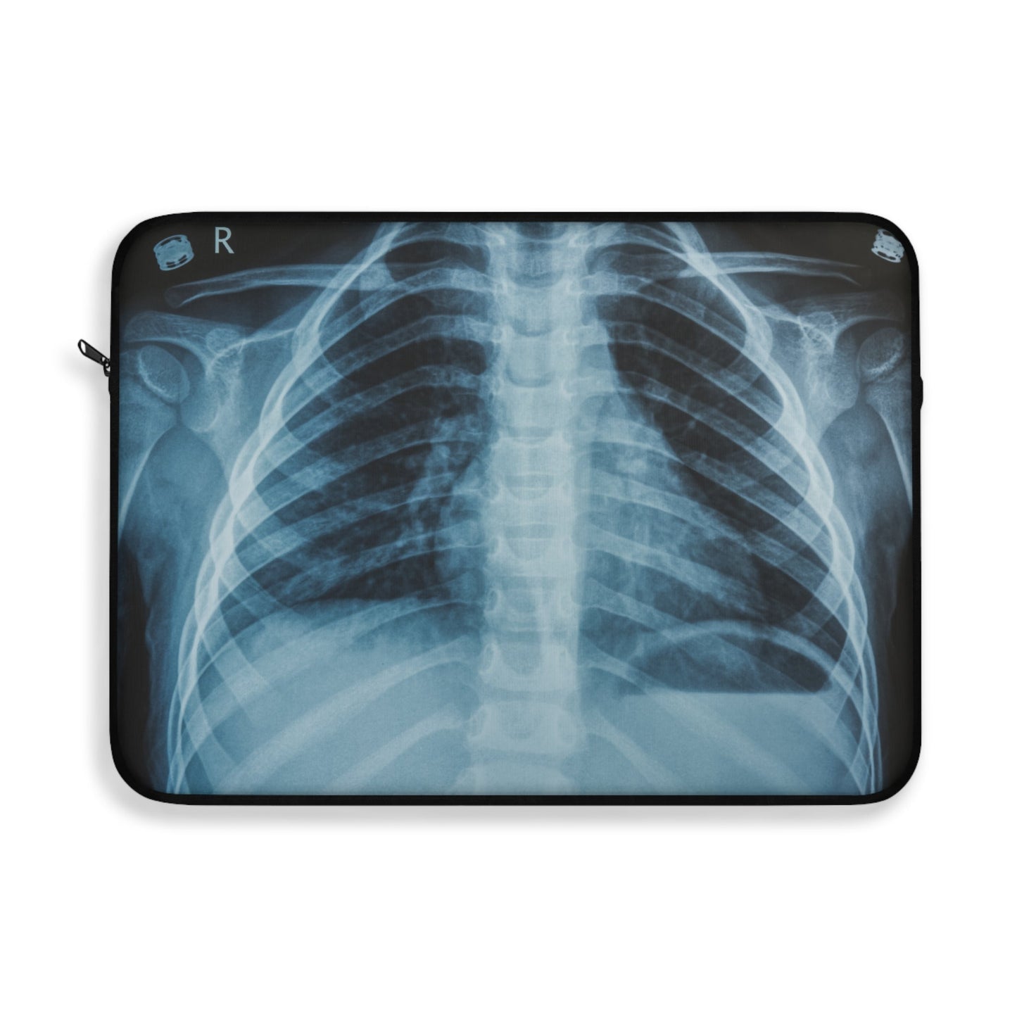 Sleevies – Rib scan